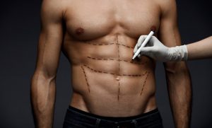 abs with marker marks