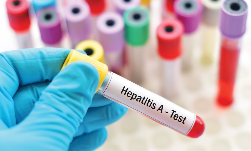 Hepatitis A